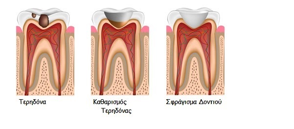 Οδοντίατροι Αλεξανδρούπολη Τσιρτσίδης Α. Σαράντης 